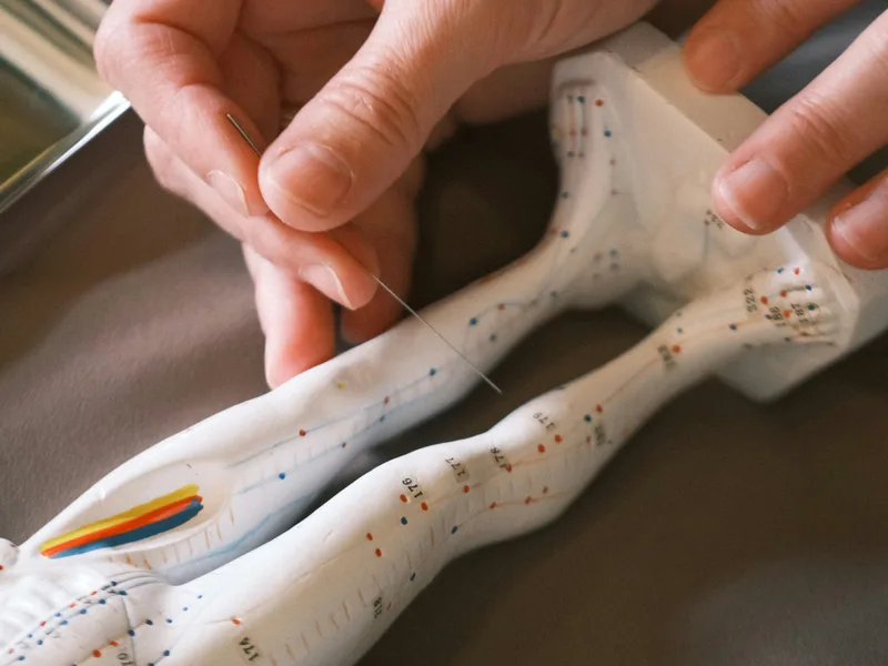 Acupuncture at Camel City Chiropractic in Hudsonville
