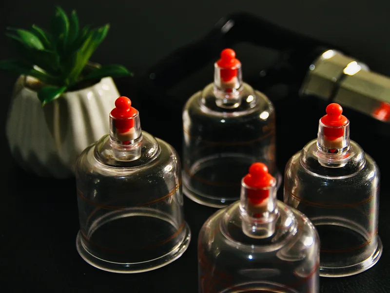 How Cupping Therapy works at Camel City Chiropractic