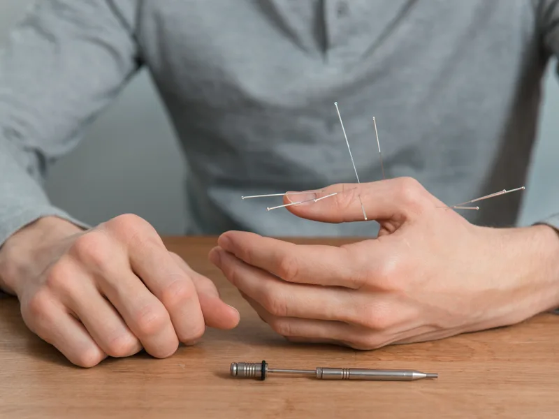 Dry Needling at Camel City Chiropractic in Hudsonville