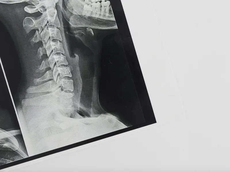 X-Rays at Camel City Chiropractic in Hudsonville