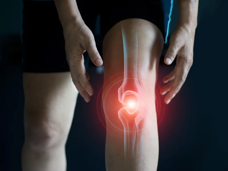 How Camel City Chiropractic treats arthritis in Hudsonville